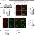 Dax1 in AgRP neurons regulates thermogenesis via GR-HDAC3-mediated CRFR1 suppression